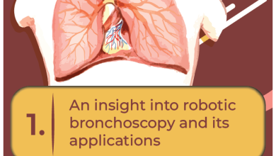 Photo of How is the adoption of robotics enhancing patient outcomes in bronchoscopy?